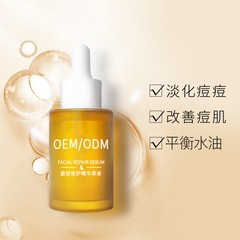 江门市_祛痘精华原液OEM